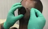 عكاسي كه دوربين پشت سرش كار گذاشت!
