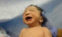 چشم و همچشمی در سزارین!