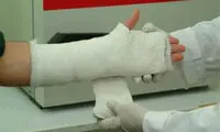 در مواجهه با شکستگی دست و پا چه کنیم؟