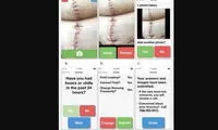 رصد عفونت زخم جراحی با یک اپلیکیشن