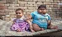 نگرانی از چاقی مفرط کودک هندی + عکس