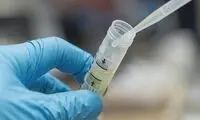 از علائم تا پیشگیری عفونت دستگاه ادراری
