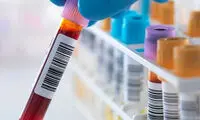 پیش‌بینی انواع بیماری با یک آزمایش خون