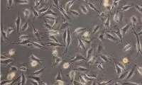 بررسی امکان پرورش رگ‌های خونی در فضا
