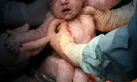 تصاویری شگفت انگیز از لحظه تولد انسان