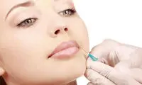 بوتاکس، راز جوانی ستارگان هالیوود