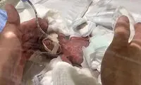 کوچکترین نوزاد پسر دنیا به خانه رفت