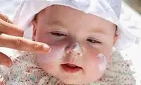 مراقبت از پوست كودك در فصل سرما