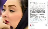 الهام حمیدی: ظاهرا وضع هنرمندان خوب است، اما چنین نیست