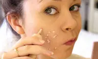 چگونه با استفاده از آرایش جای زخم را پنهان کنید؟