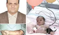 برای اولین بار: پیوند دست کودک 13 ماهه در شیراز