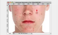 روتوش عکس با فتوشاپ؛ برداشتن لکه های صورت