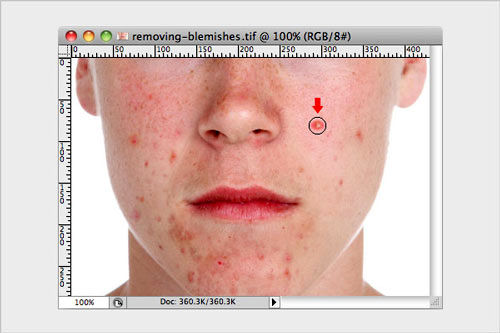 روتوش عکس با فتوشاپ؛ برداشتن لکه های صورت