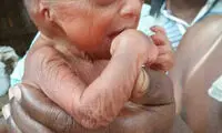 تولد نوزاد 110 ساله عجیب الخلقه! +عکس