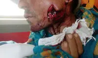 حمله پلنگ به یک چوپان در کلاله