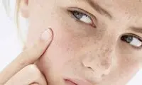 لک بارداری و راه‌های درمان آن