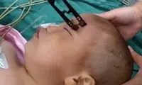 نجات باور نکردنی پسر 2 ساله از مرگ +عکس