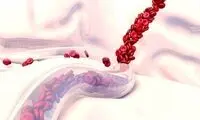 عوامل و علائم خونریزی داخلی