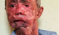 آدم هایی که مثل کره ذوب میشوند (16+)