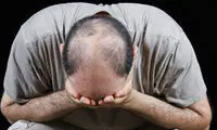 مراقب استفاده از داروی Propecia باشید