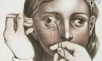 عمل های جراحی در قرن نوزدهم +عکس