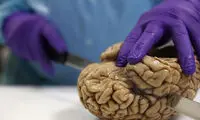 مغزتان را اهدا کنید +عکس