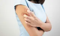 داشتن خال در نقاط مختلف بدن به چه معناست؟