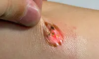 اندازه گیری ضربان فقط با یک برچسب!