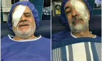 چشم راست عارف و چپ حدادعادل تار می بیند