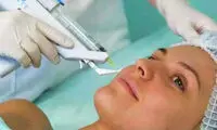 ليزر موهاي زائد برای این افراد ممنوع است