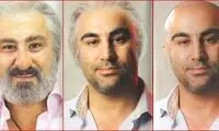مراحل گریم تنابنده در «شاه گوش» +عکس