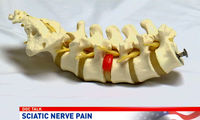 درد سیاتیک؛ علت‌ها و درمان آن