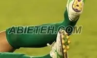 پای فریدون زندی دو نیم شد! +عکس