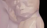 مشاهده جنین داخل رحم با واقعیت مجازی