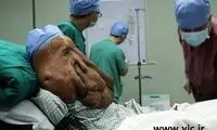 جداسازی 19 کیلو از تومور مرد فیلی (16+)