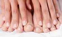 ناخن هایت این شکلی شده؟