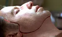 فیس آف؛ تغییر چهره با تیغ جراحی