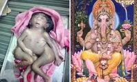 نوزادِ انسان چهارپا، خدای جدید هندی‌ها