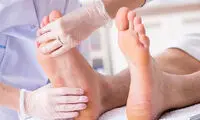 مطالبی که هیچگاه درباره نقرس نشنیده‌اید!