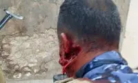 عکس: فاصله مرگ و زندگی در جنگ