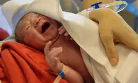 سزارین هم لاکچری شد؛ تراژدی تولد نوزادان در ۹۷/۷/۷