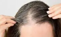 استرس، موها را خاکستری می‌کند اما قابل برگشت است!