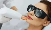 لیزر اربیوم چیست و در چه مواردی کاربرد دارد؟