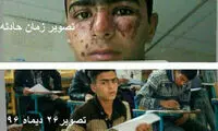 ماجرای سوختگی دانش‌ آموز زهکی در مدرسه
