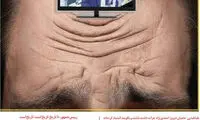 کارتون؛ پخش برنامه طنز با روبان سیاه از صداوسیما