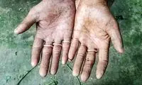 خانواده‌ای که اثر انگشت ندارد