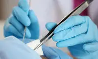 هورمون درمانی با کاشت کپسول تستوسترون