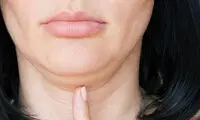 راهکار‌های طلایی برای رهایی از غبغب