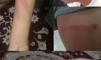 تنبیه بی رحمانه یک دانش آموز در قاین