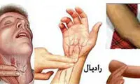 روش اندازه گیری نبض